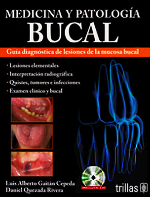 MEDICINA Y PATOLOGIA BUCAL: GUIA DIAGNOSTICA DE LESIONES DE LA MUCOSA BUCAL (INCLUYE CD)