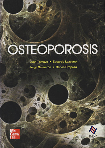 OSTEOPOROSIS
