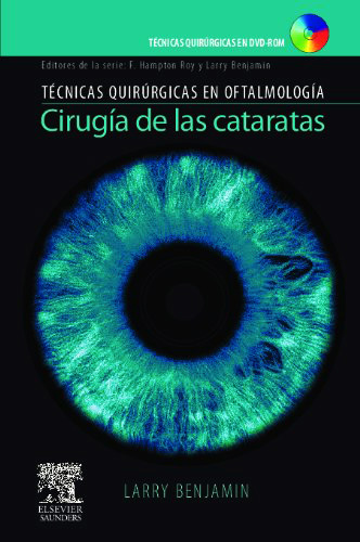 CIRUGIA DE LAS CATARATAS (INCLUYE DVD)
