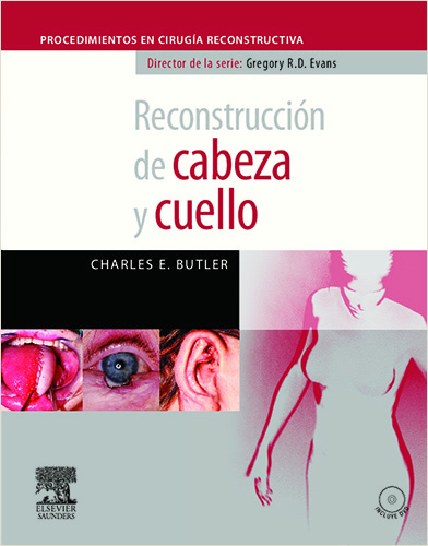 RECONSTRUCCION DE CABEZA Y CUELLO