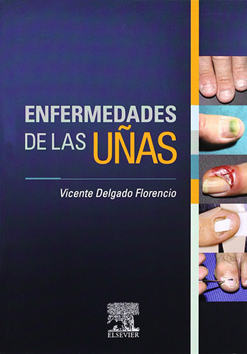 ENFERMEDADES DE LAS UÑAS