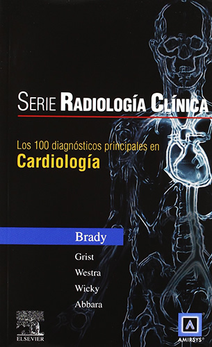 100 DIAGNOSTICOS PRINCIPALES EN CARDIOLOGIA