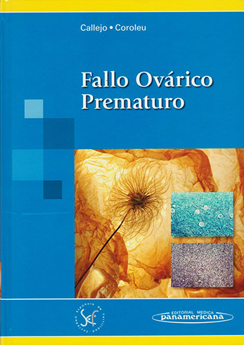 FALLO OVARICO PREMATURO