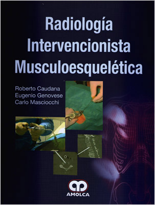 RADIOLOGIA INTERVENCIONISTA MUSCULOESQUELETICA