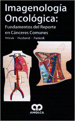 IMAGENOLOGIA ONCOLOGICA: FUNDAMENTOS DEL REPORTE EN CANCERES COMUNES