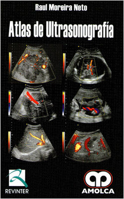 ATLAS DE ULTRASONOGRAFIA