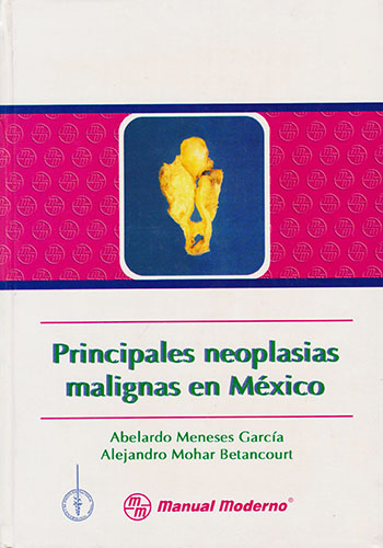 PRINCIPALES NEOPLASIAS MALIGNAS EN MEXICO