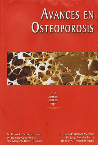 AVANCES EN OSTEOPOROSIS