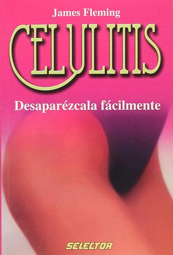 CELULITIS