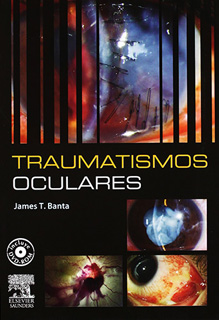 TRAUMATISMOS OCULARES (INCLUYE DVD)