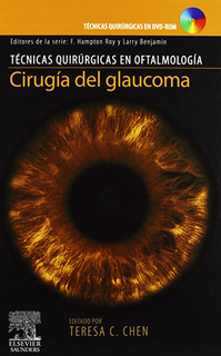 CIRUGIA DEL GLAUCOMA (TECNICAS QUIRURGICAS EN...