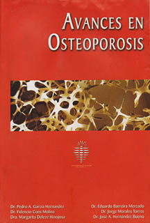 AVANCES EN OSTEOPOROSIS